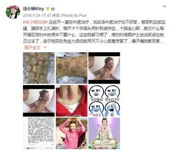 “千萬(wàn)別化療，一化療人就沒(méi)了”？化療究竟會(huì)不會(huì)讓人死得更快？