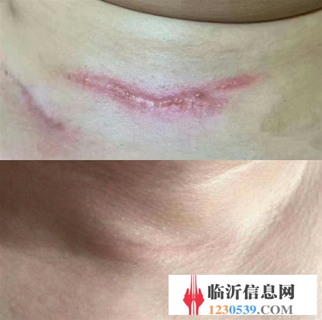 修復(fù)斑疤痘敏，各種問題性皮膚